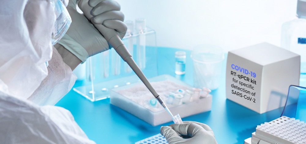 पीसीआर जाँच शुल्क घट्यो