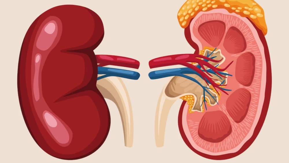 आज विश्व मृगौला दिवस मनाईंदै