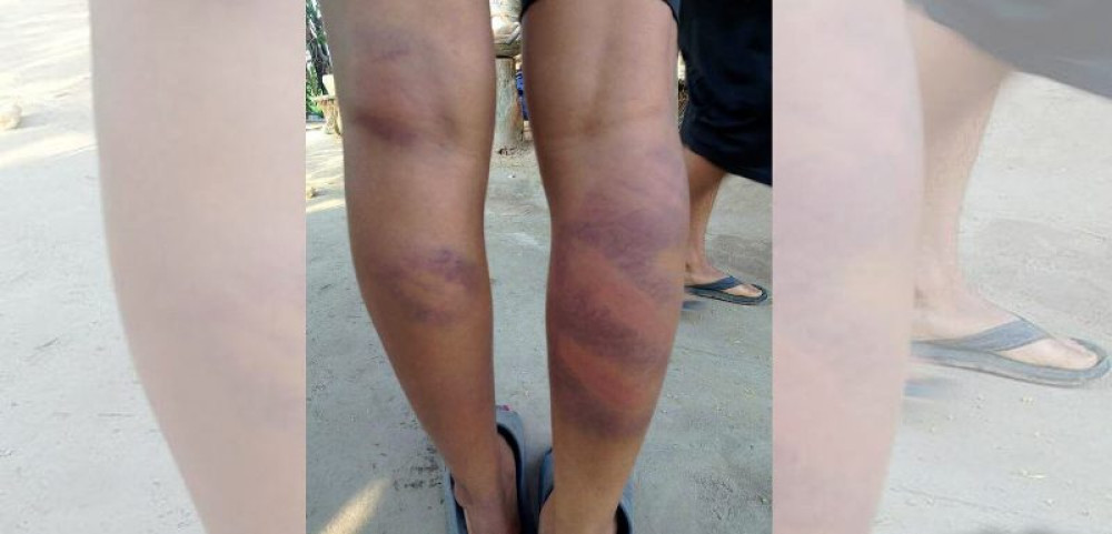 विद्यार्थीलाई यातना दिएको घटनाको छानबिन गर्न कमलले बनायो समिति