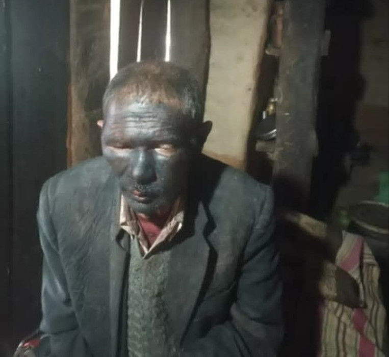 जिउँदै मानिस जलाउन खोज्ने चार जना प्रहरी नियन्त्रणमा