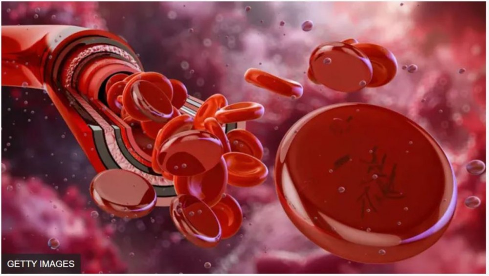 भारतमा भेटियो दुर्लभ रक्तसमूह, नाम राखियो ‘सी.आर.आई.बी.’