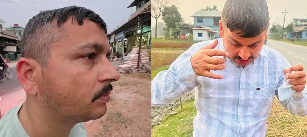 एमाले कार्यकर्ताद्वारा झापामा पत्रकारमाथि आक्रमण